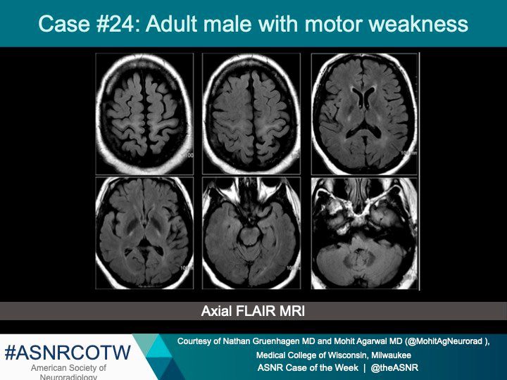 Asnr Case Of The Week Case 24 American Society Of Neuroradiology