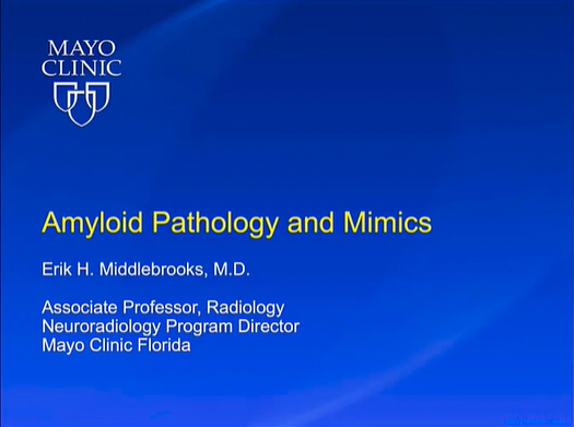 Amyloid Pathology and Mimics thumbnail