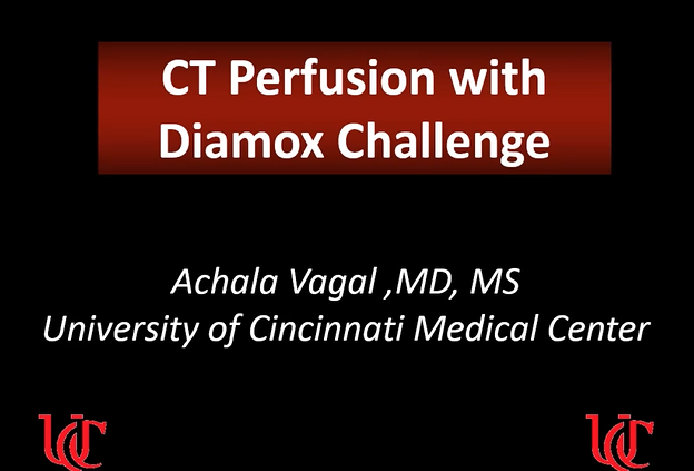 CT Perfusion with Diamox Challenge thumbnail