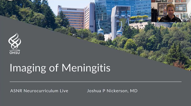 Imaging of Meningitis thumbnail