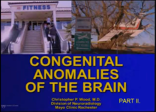 Congenital Anomalies of the Brain, Part 2 thumbnail