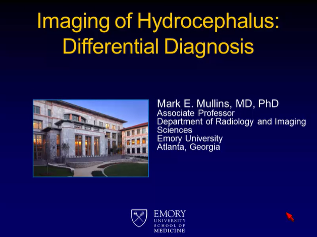 Imaging of Hydrocephalus: Part II. Differential Diagnosis thumbnail