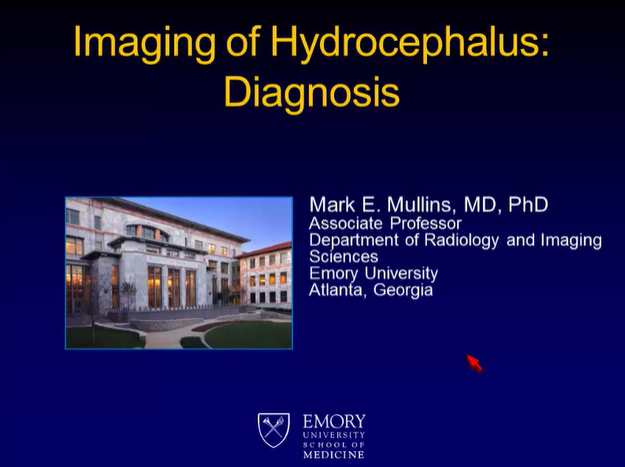 Imaging of Hydrocephalus: Part III. Diagnosis thumbnail