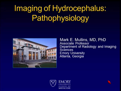 Imaging of Hydrocephalus: Part I. Pathophysiology thumbnail