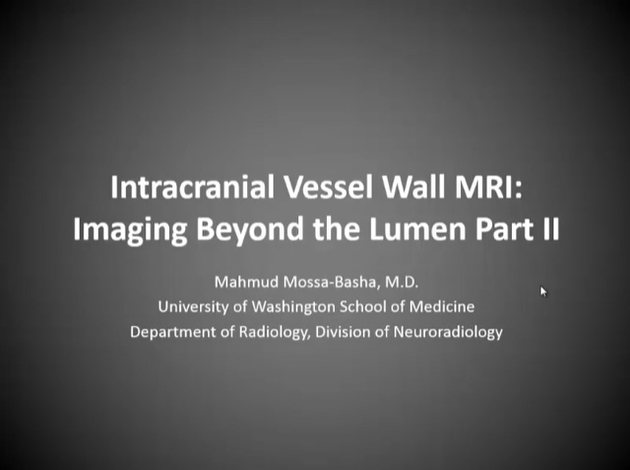 Intracranial Vessel Wall MRI: Imaging Beyond the Lumen, Part 2 thumbnail
