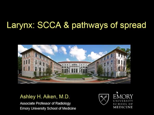 Larynx: SCCA & Pathways of Spread thumbnail