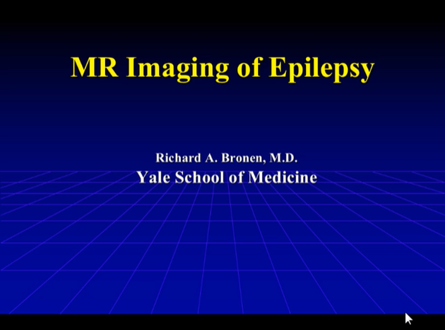 MR Imaging of Epilepsy thumbnail