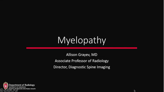 Myelopathy thumbnail