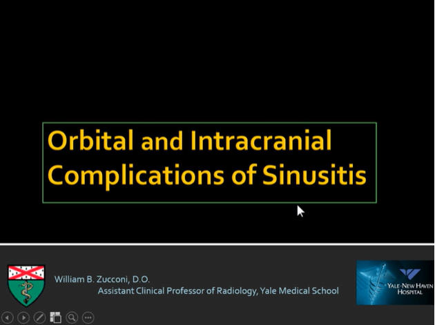 Orbital and Intracranial Complications of Sinusitis thumbnail