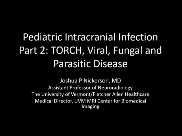 Pediatric Intracranial Infection. Part 2: TORCH, Viral, Fungal and Parasitic Disease thumbnail