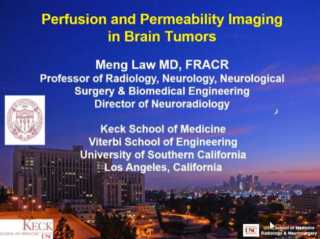 Perfusion and Permeability Imaging in Brain Tumors thumbnail