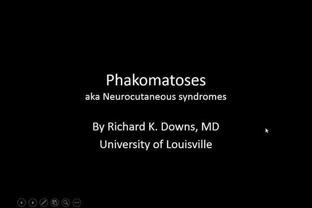 Phakomatoses thumbnail