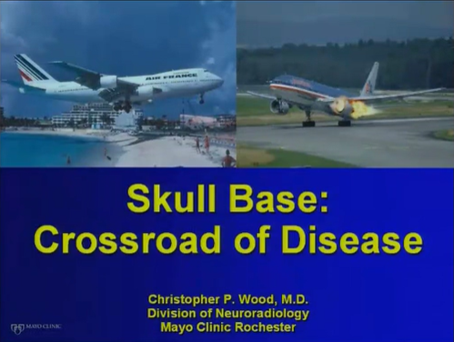 Skull Base: Crossroad of Disease, Part 3 thumbnail
