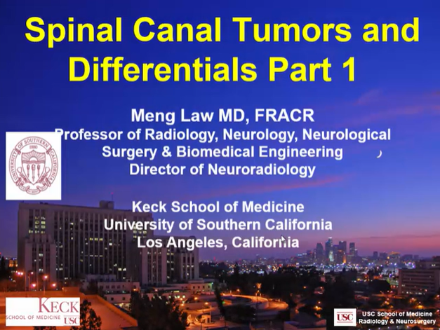 Spinal Canal Tumors and Differentials, Part 1 thumbnail