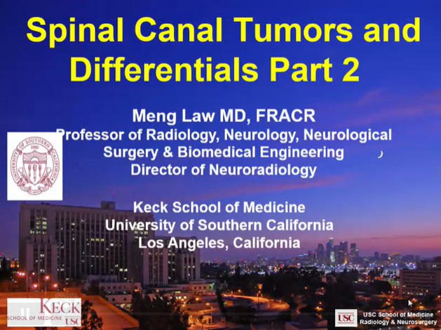 Spinal Canal Tumors and Differentials, Part 2 thumbnail