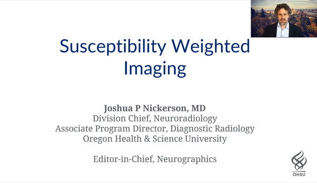 Susceptibility Weighted Imaging thumbnail