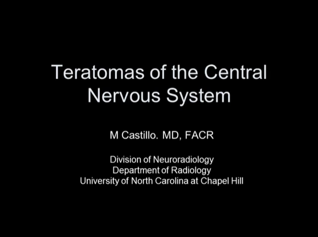 Teratomas of the Central Nervous System thumbnail