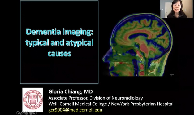 Dementia Imaging: Typical and Atypical Causes thumbnail