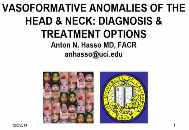 Vasoformative Anomalies of the Head and Neck: Diagnosis and Treatment Options thumbnail