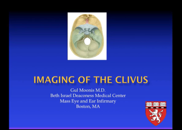 Imaging of the Clivus thumbnail