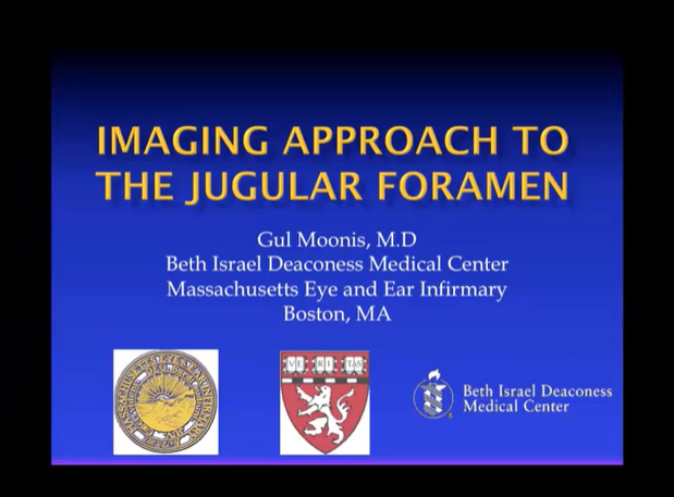 Imaging Approach to the Jugular Foramen thumbnail